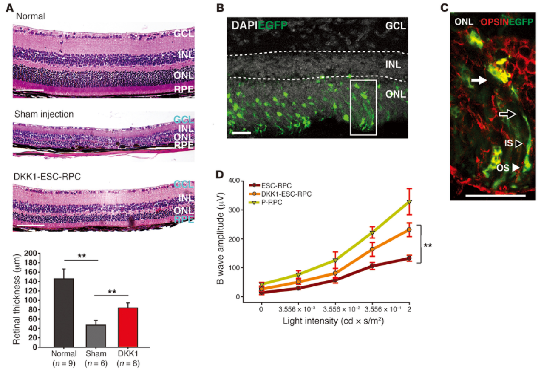 Pipeline 3: iPSC-RPC transplantation for the treatment of retinitis pigmentosa